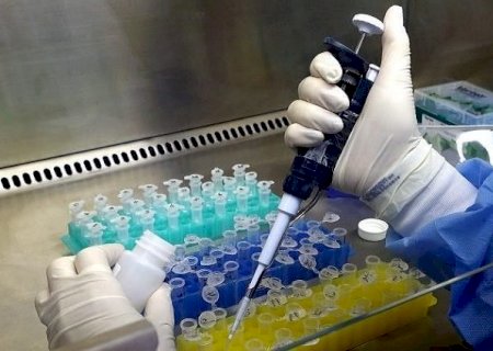 Pesquisa do Procon/MS aponta variação de até 1.532,50% no preço de exames laboratoriais