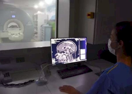 HU da Capital busca voluntários para estudo sobre AVC
